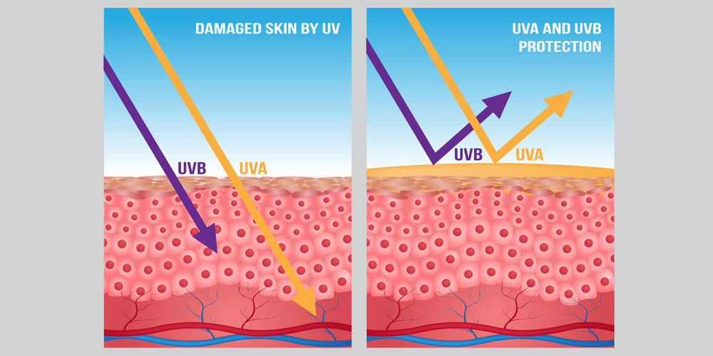 کرم ضد آفتاب
