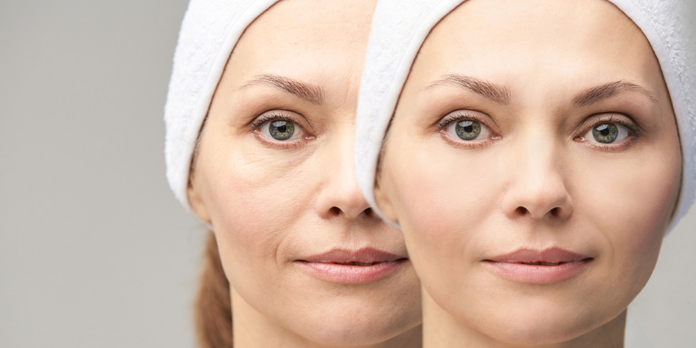 چرا کرم سوپر لیفت آراکسین تفاوت می‌کند؟