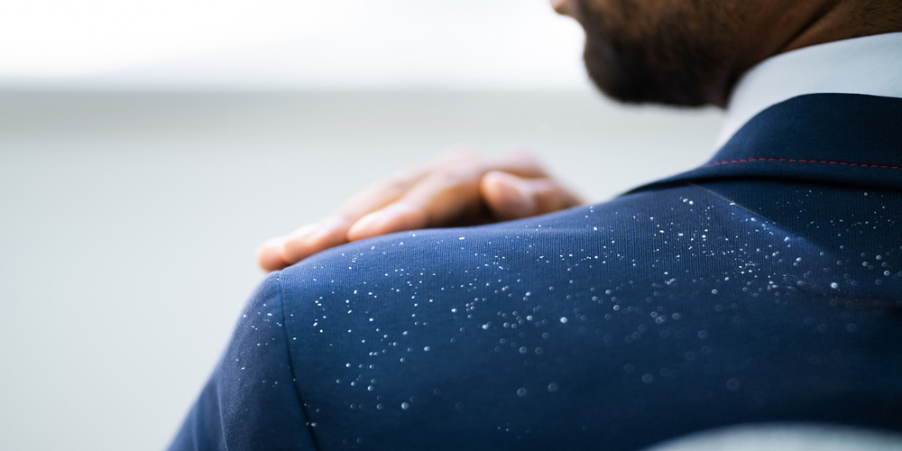 شامپو ضد شوره و ترکیبات آن