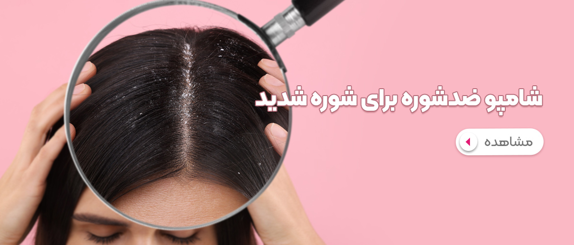 رفع شوره سر