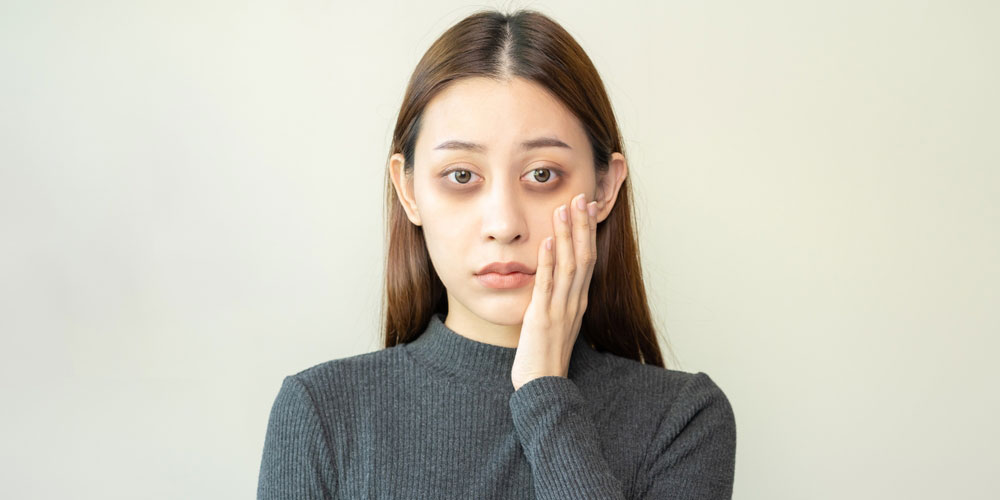 تیرگی و پف دور چشم