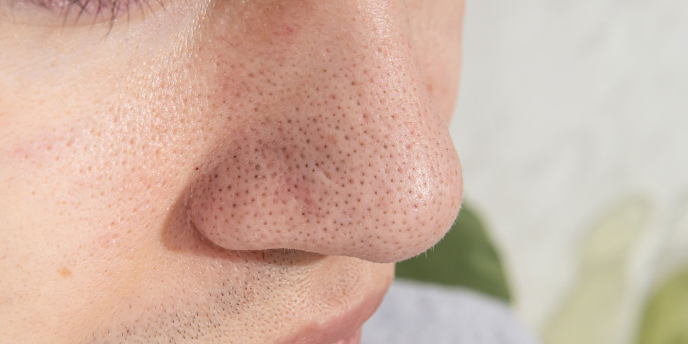 پاکسازی عمقی پوست صورت