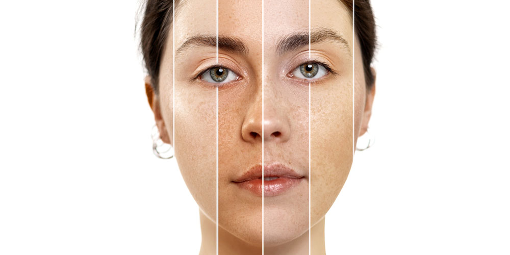 کرم‌های روشن‌کننده با اثر سریع و بدون حساسیت،