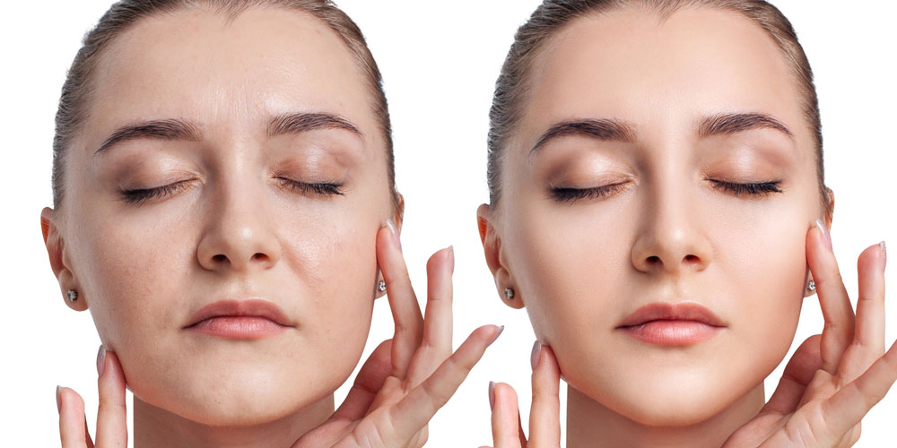 افراط در پاکسازی پوست چگونه اتفاق می‌افتد؟