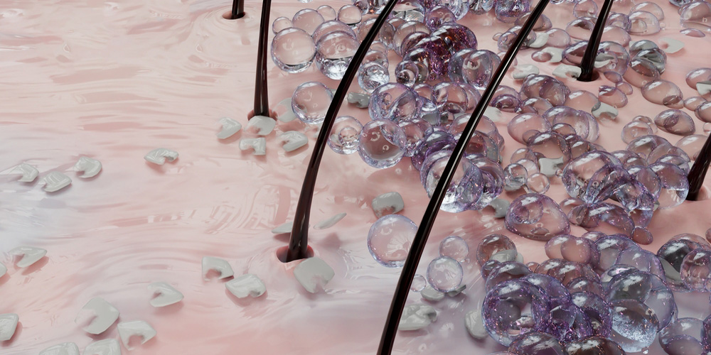 شامپو ضد شوره مناسب موهای کاشته شده؛ راهنمای جامع انتخاب و استفاده