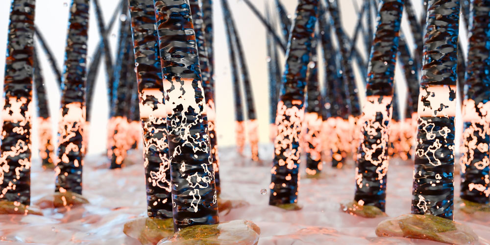 شوره سر چیست و چرا به وجود می‌آید؟