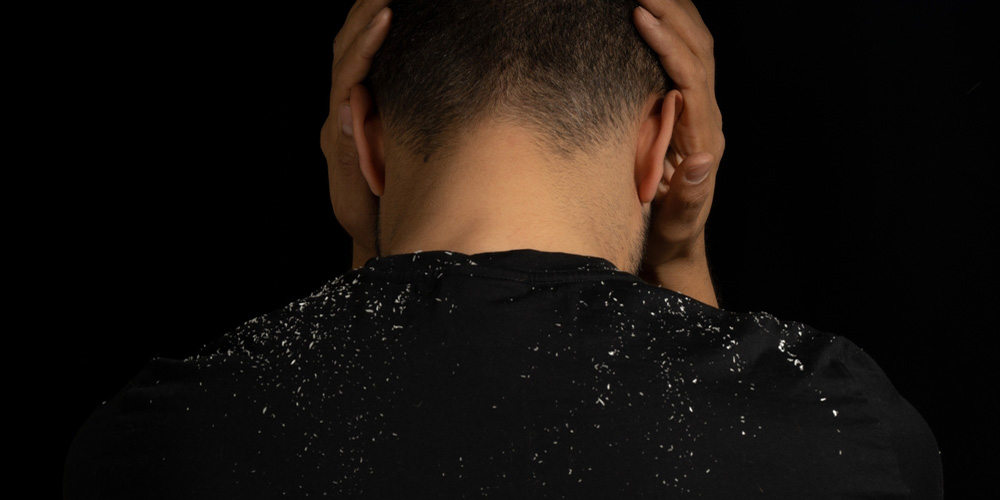 آیا شامپو ضد شوره به تنهایی کافی است