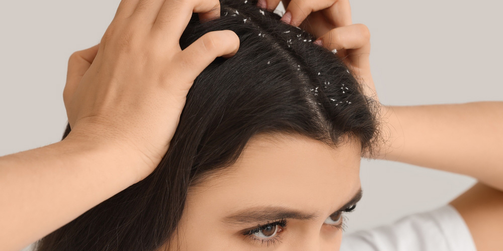 راهنمای جامع انتخاب بهترین شامپو ضد شوره بر اساس نوع پوست سر و مو