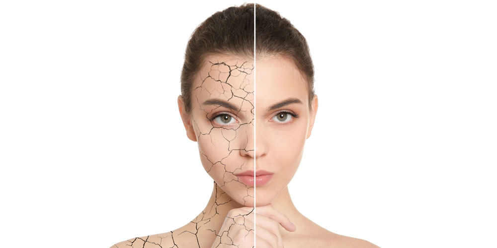 آرایش پوست خشک؛ چگونه پوستی مرطوب، شاداب و درخشان داشته باشیم؟